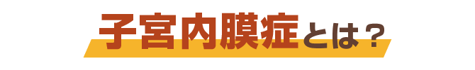 子宮内膜症とは?