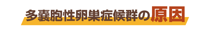 多嚢胞性卵巣症候群の原因