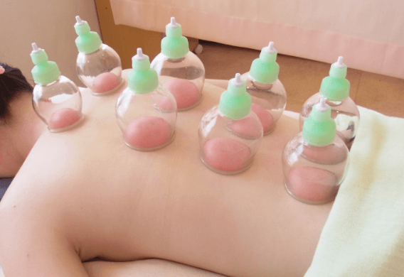 吸角 江東区住吉で実績no 1の鍼灸院 住吉鍼灸院